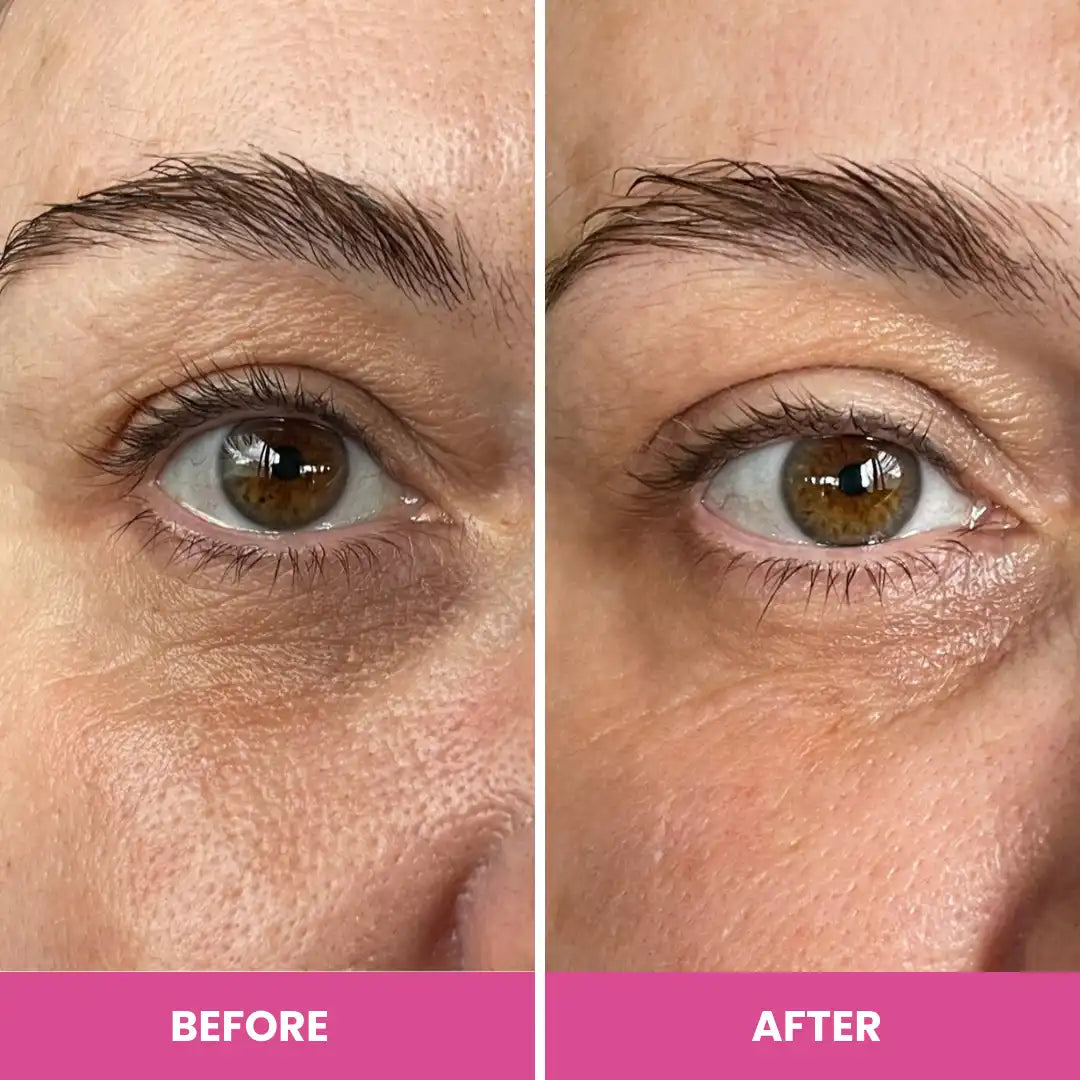 PrimeEyes Hydrate