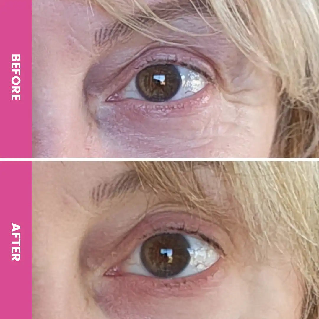 PrimeEyes Hydrate